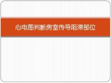 心电图判断房室传导阻滞部位
