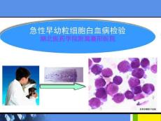 急性早幼粒细胞白血病的检验