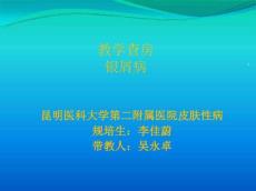 教学查房银屑病