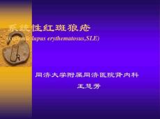 系统性红斑狼疮11694