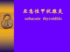 亚急性甲状腺炎课件