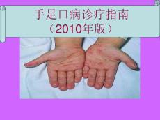 手足口病解读