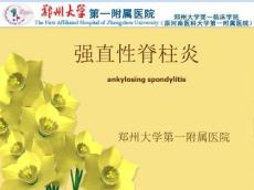 强直性脊柱炎