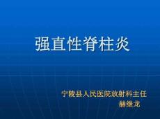 强直性脊柱炎14267