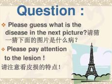 带状疱疹课件