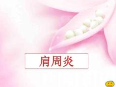 肩周炎23388
