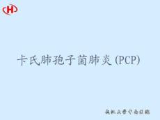 卡氏肺孢子菌肺炎