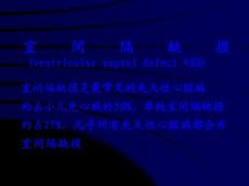 室间隔缺损ventricularseptaldefectVS