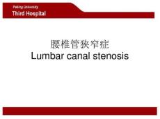 腰椎管狭窄症1055