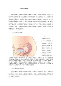 怎样防治子宫脱垂