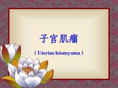 子宫肌瘤10696