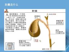 急性胆囊炎.