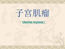 子宫肌瘤10662