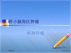 听神经鞘瘤