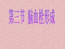 脑血栓ct检查