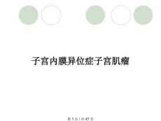 子宫内膜异位症子宫肌瘤