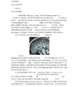多系统萎缩
