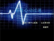 室性心动过速4120