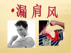 针灸治疗--漏肩风、臂丛神经痛、肘劳