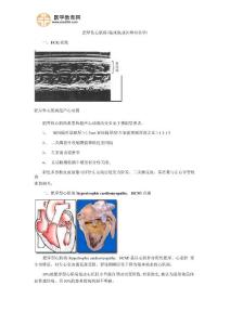 肥厚性心肌病