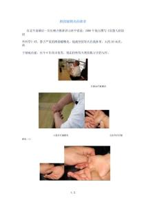 拇指腱鞘炎的推拿