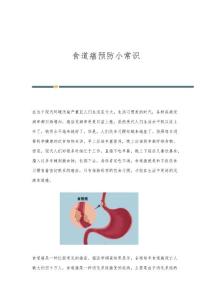 食道癌预防小常识