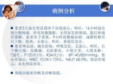 急性阑尾炎