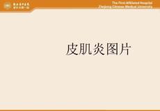 皮肌炎图片课件