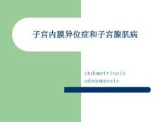 子宫内膜异位症_2