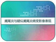 阑尾炎与疑似阑尾炎病变影像表现PPT