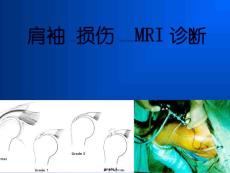 肩关节损伤MRIPPT课件