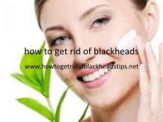 How to get rid of blackheads ppt