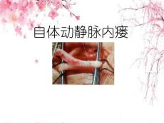 自体动静脉内瘘