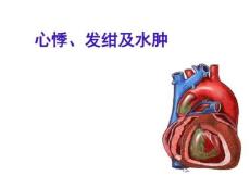 《心悸发绀水肿》