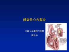 感染心内膜炎资料