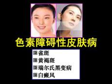 色素障碍性皮肤病