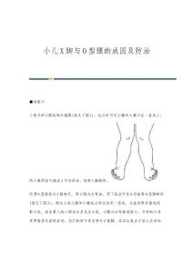 小儿X脚与O型腿的成因及防治