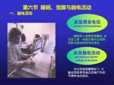 睡眠机制与睡眠障碍33200