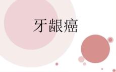 牙龈癌的护理37895