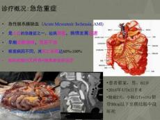 急性肠系膜缺血性疾病诊治