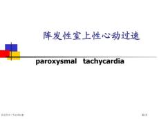 阵发性室上性心动过速专家讲座