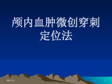 颅内血肿穿刺定位法