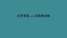 克罗恩病影像诊断