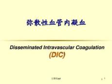 dic弥散性血管内凝血课件