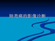 肺类癌的影像诊断