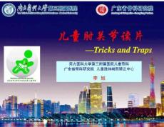 儿童肘关节读片