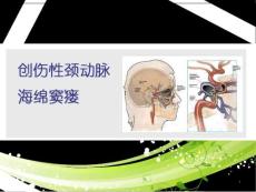 创伤性颈动脉海绵窦瘘--课件