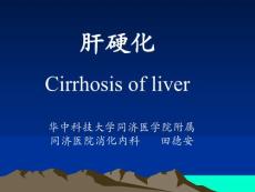 肝硬化