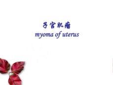 子宫肌瘤-