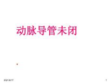 《动脉导管未闭》课件